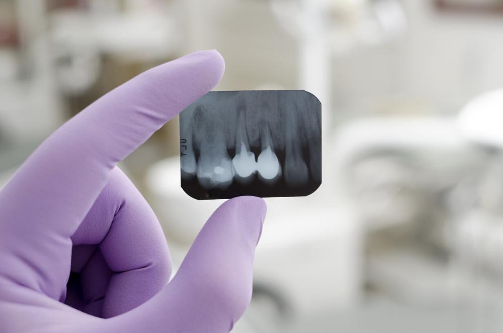 dentist's hand holding xray